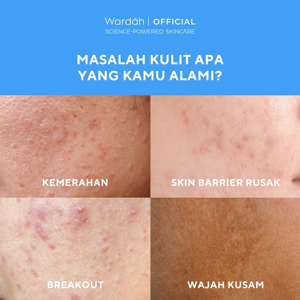 Wardah Sunscreen UV Shield Physical Serum SPF 50 PA 30 ml - Sunscreen Wajah Ringan, Tidak Whitecast, Cepat Meresap, Melembutkan Kulit - Sunscreen No. 1 Sunscreen of the Year - Skincare - Gambar 4