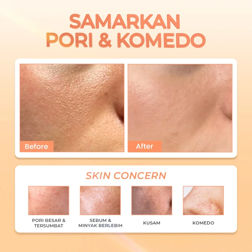 Hanasui Power Mini Pore Serum - Kurangi Komedo & Kontrol Minyak Berlebih Pori tersumbat Salicylic Acid - Gambar 3
