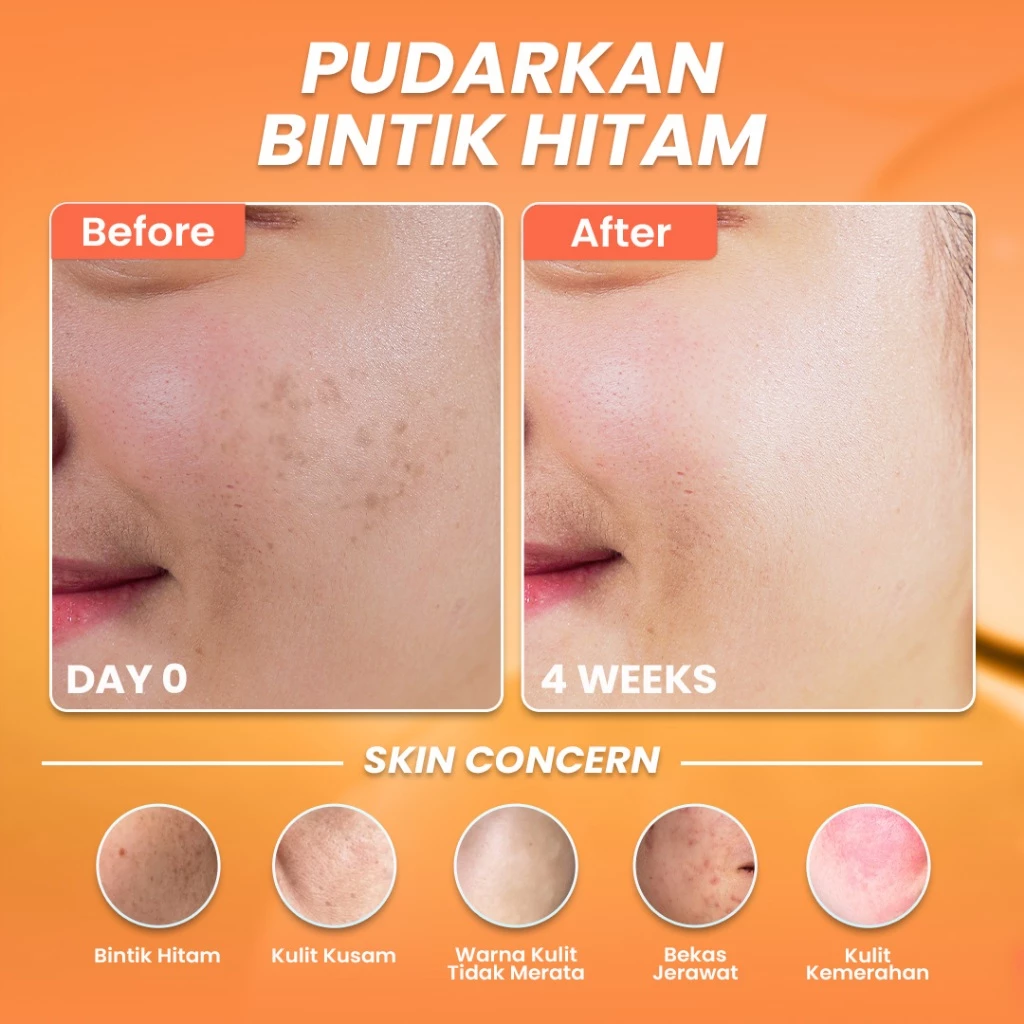 Hanasui Serum Vitamin C - Mencerahkan & Pudarkan Bintik Hitam 2% Vitamin C 2% Niacinamide 1% Betaine - Gambar 3