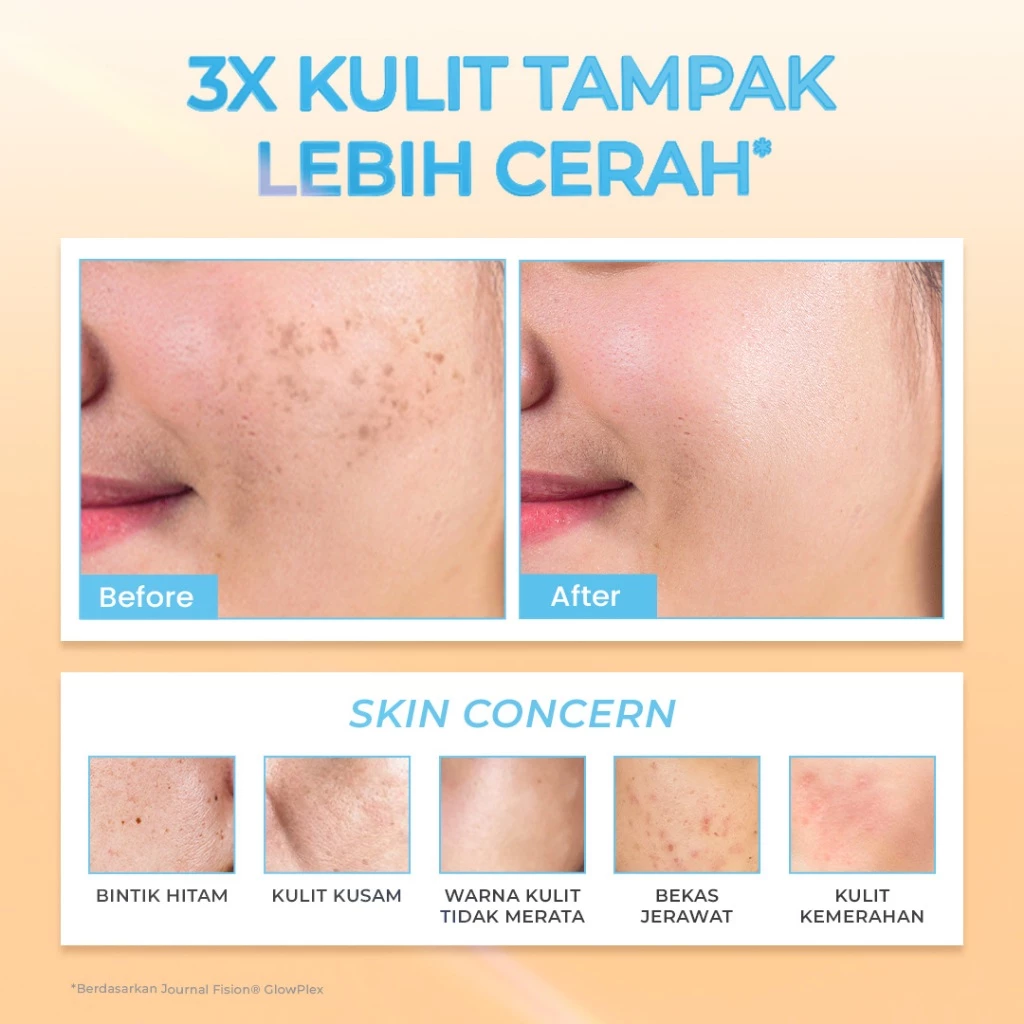Hanasui Power Bright Serum - 5% Advance Niacinamide Mencerahkan, Kurangi Bintik Hitam Bekas Jerawat, Ratakan Warna Kulit - Gambar 4