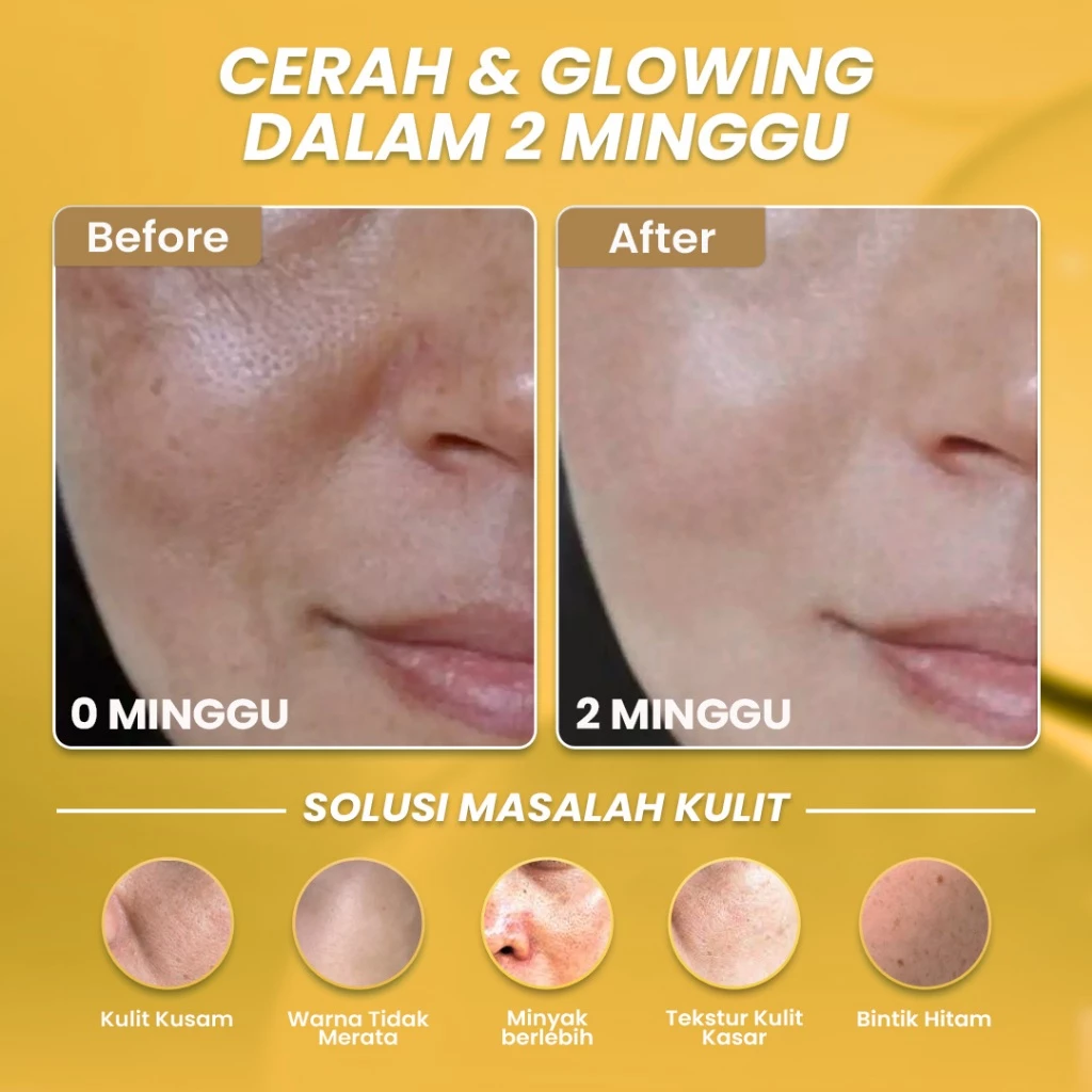 Hanasui Whitening Gold Serum - Cerah & Glowing Kurangi Bintik Hitam & Lawan Tanda Penuaan 4% Niacinamide & 2% Vitamin C - Gambar 2