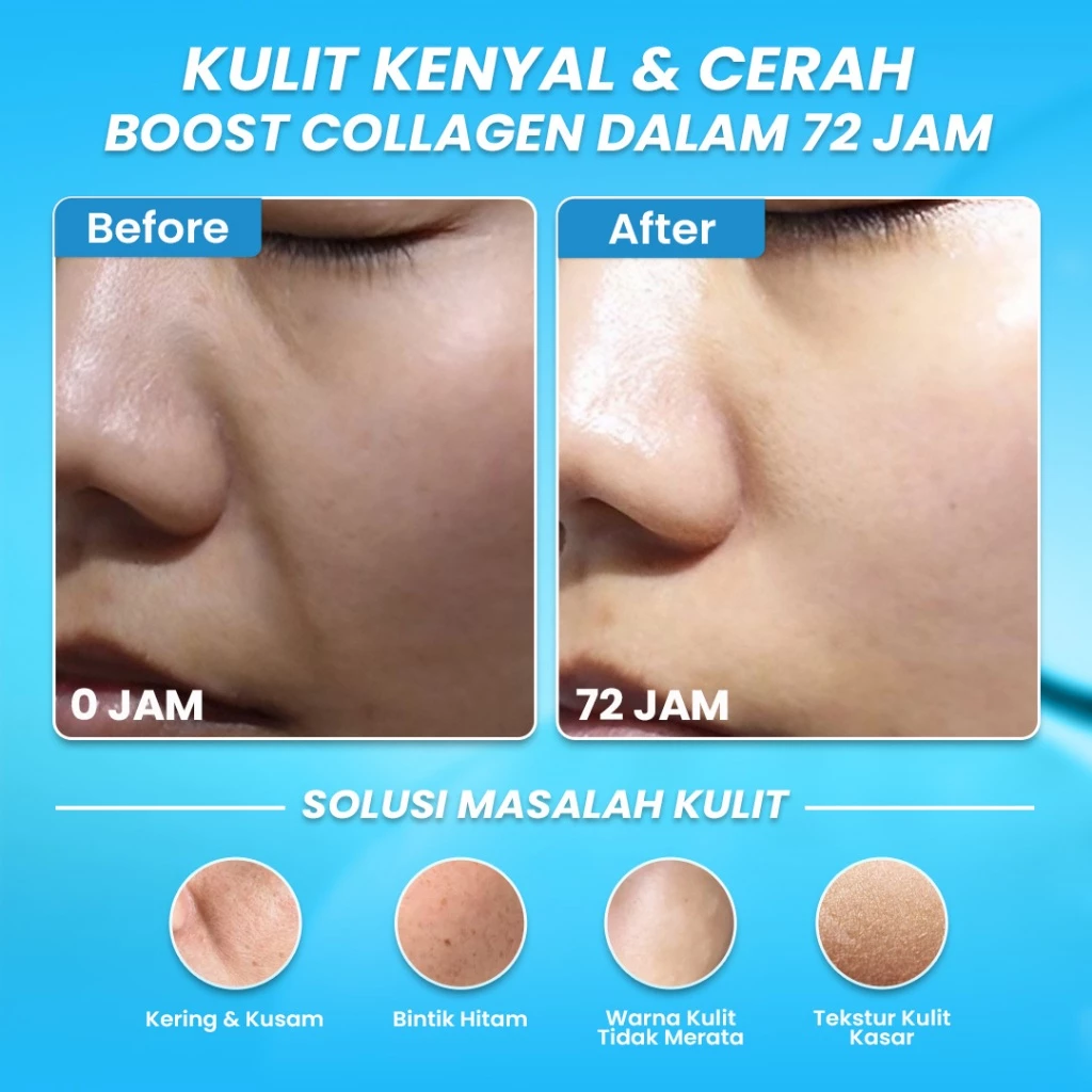 Hanasui Vitamin C + Collagen Serum - Lembap, Hidrasi & Cerah Collagen, 2% Niacinamide & 1% Vitamin C - Gambar 3