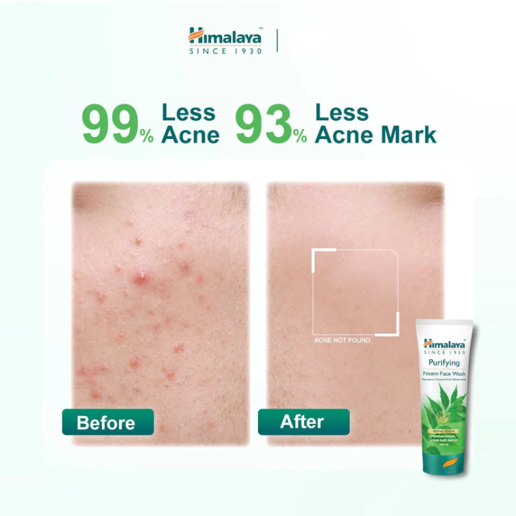 Himalaya Purifying Neem Face Wash 50ml - Sabun Cuci Muka / Distributor Cream Ori - Gambar 2
