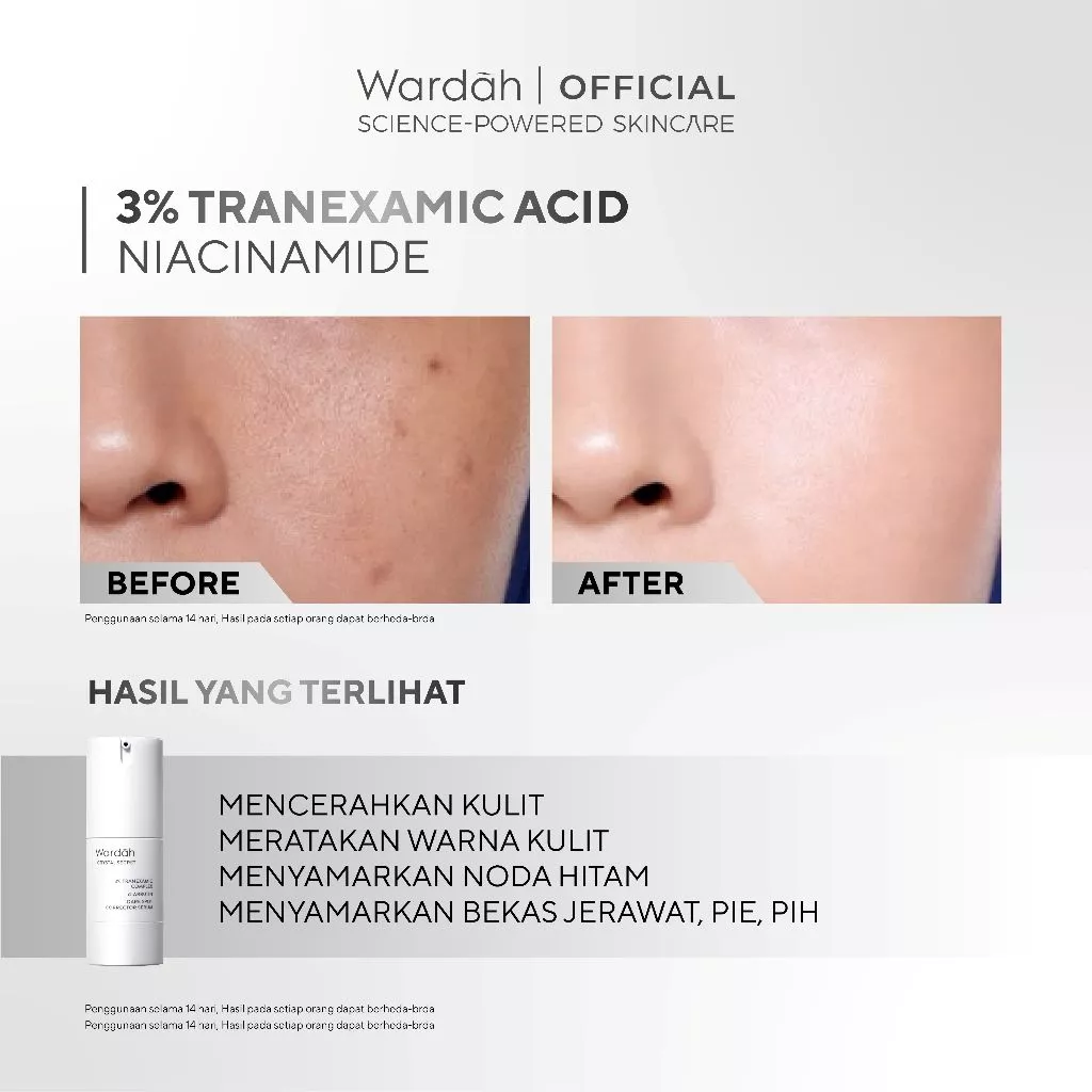 WARDAH Crystal Secret All Series Lengkap - Menyamarkan Flek dan Bekas Jerawat, Perawatan Kulit Wajah Sebening Kristal, Skin Barrier, Dark Spot Corrector - Cleanser, Toner, Serum, Day & Night Moisturizer, Radiance Serum Mask - Skincare - Gambar 3