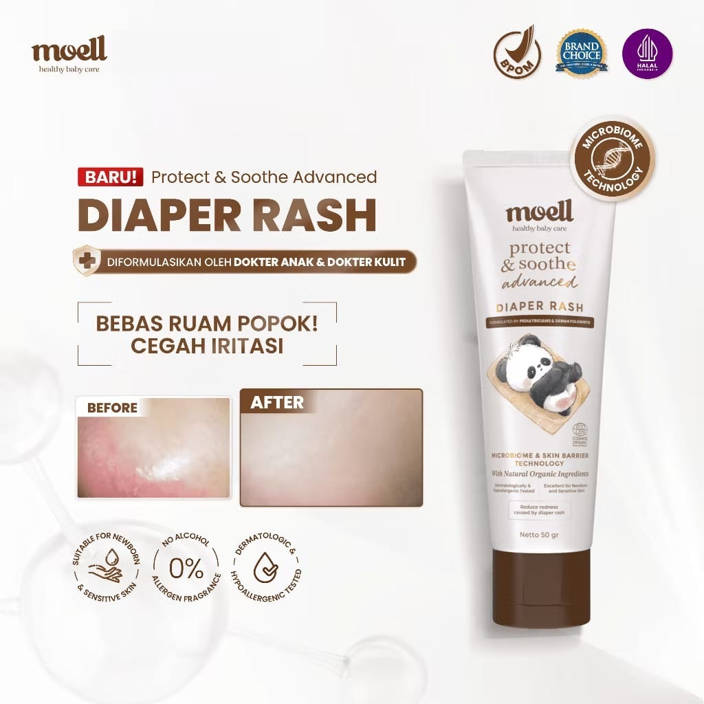 Moell Diaper Rash 50g for Sensitive Skin Cream/ Relieves and Prevent ...