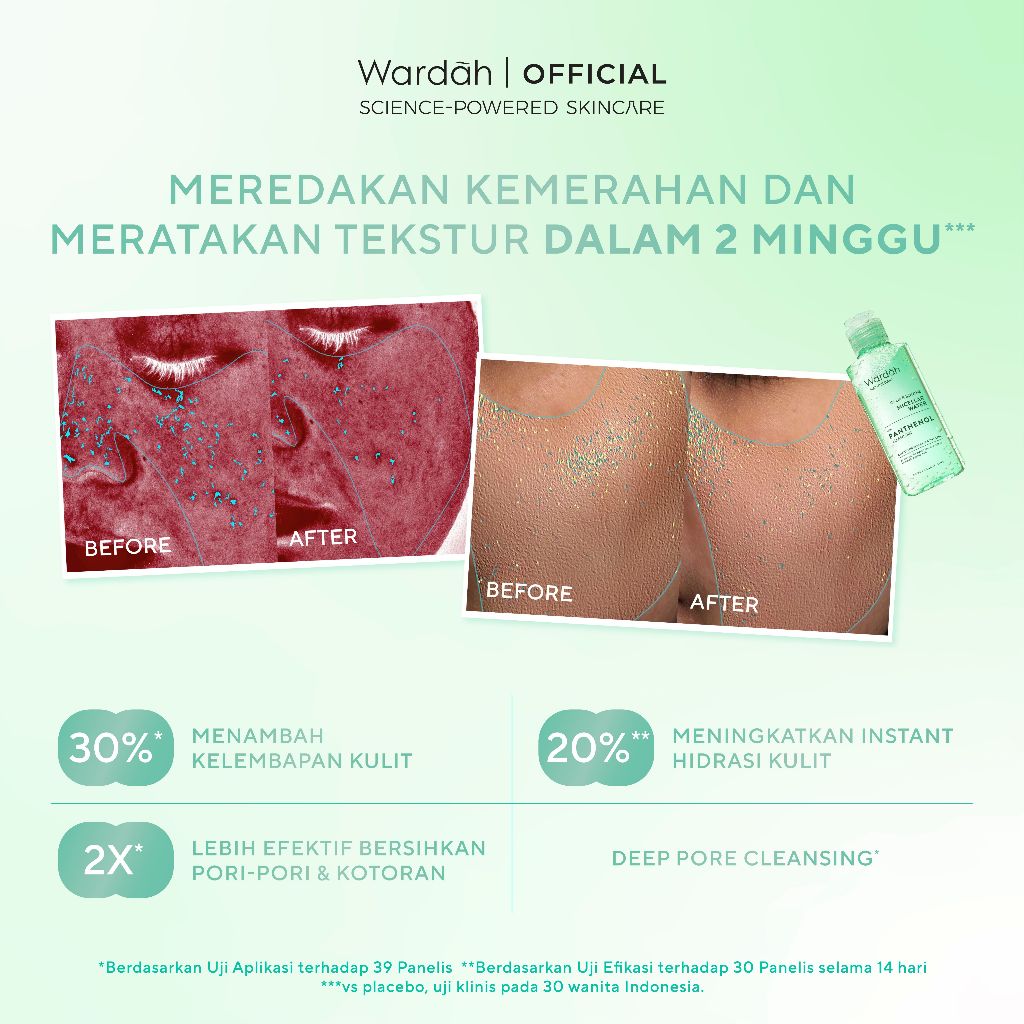 WARDAH Nature Daily Calm & Soothe Micellar Water - Skincare - Gambar 3