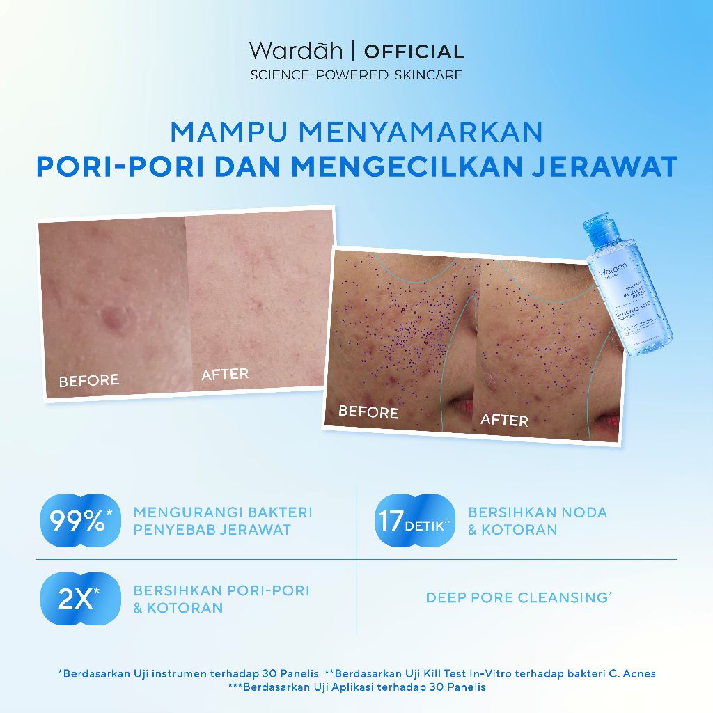 Wardah Acnederm Acne Care Micellar Water - Efektif - 50% Tanda Jerawat Berkurang - Skincare - Gambar 3