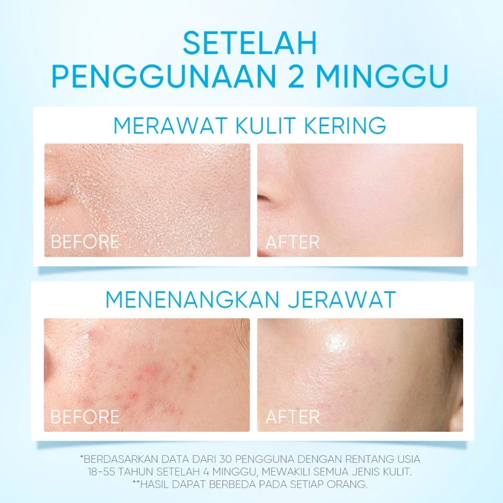 [SPECIAL AMS] SKINTIFIC - 5X Ceramide Barrier Moisturizer Gel 30g - Pelembab Ringan Lembap Perbaiki Skin Barrier - Gambar 2
