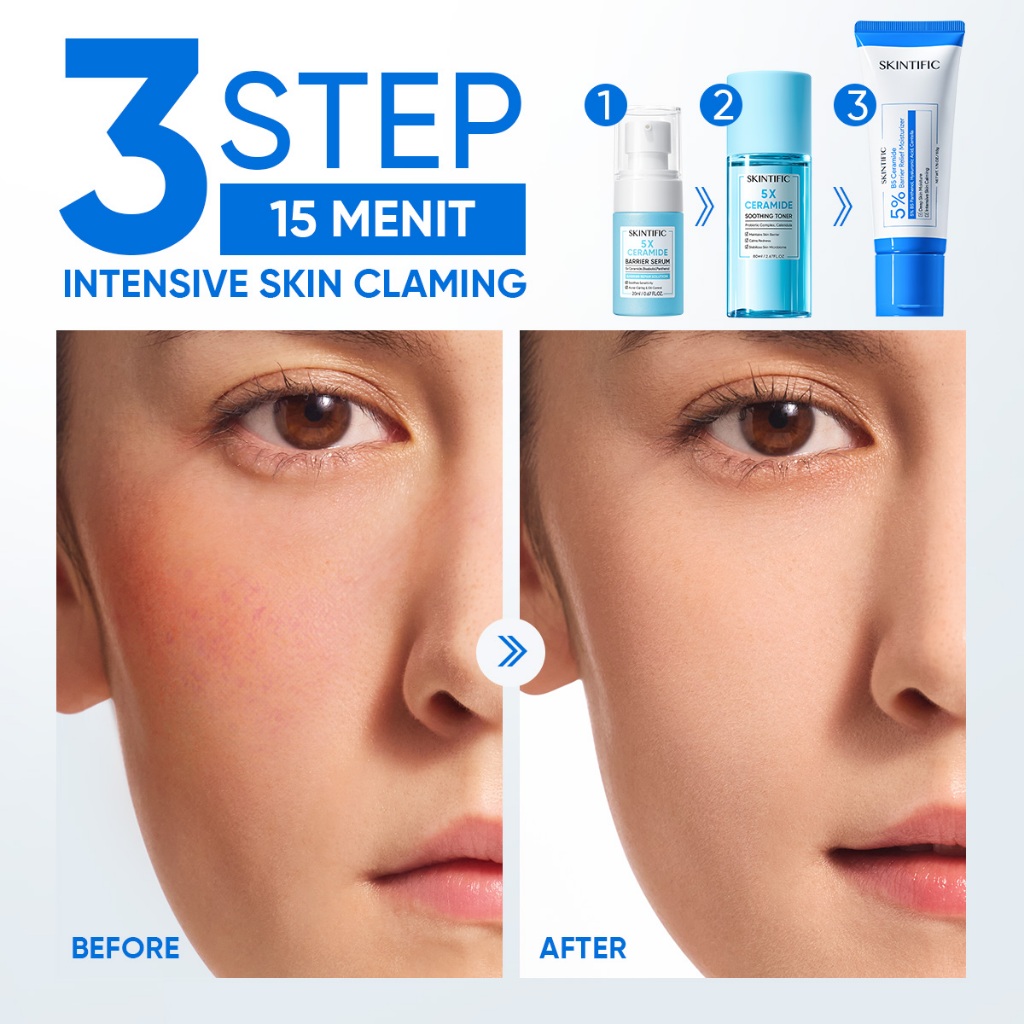 Skintific 3Pcs Ceramide Set Redness Relief Bundle - Gambar 2