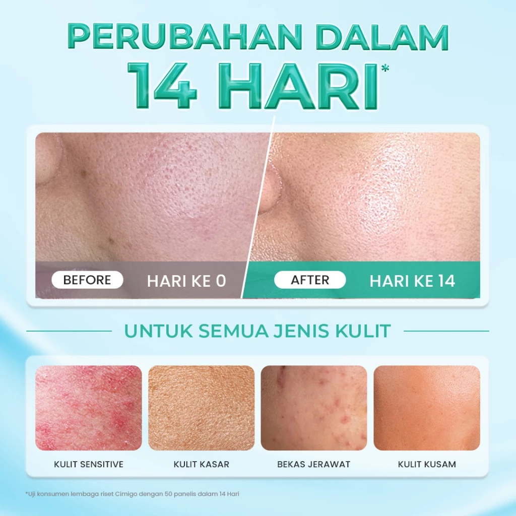 Hanasui Ceramide Probiotics Moisturizer Gel - Pelembab Ringan Lembap Perbaiki Skin Barrier dan Mencerahkan - Gambar 3