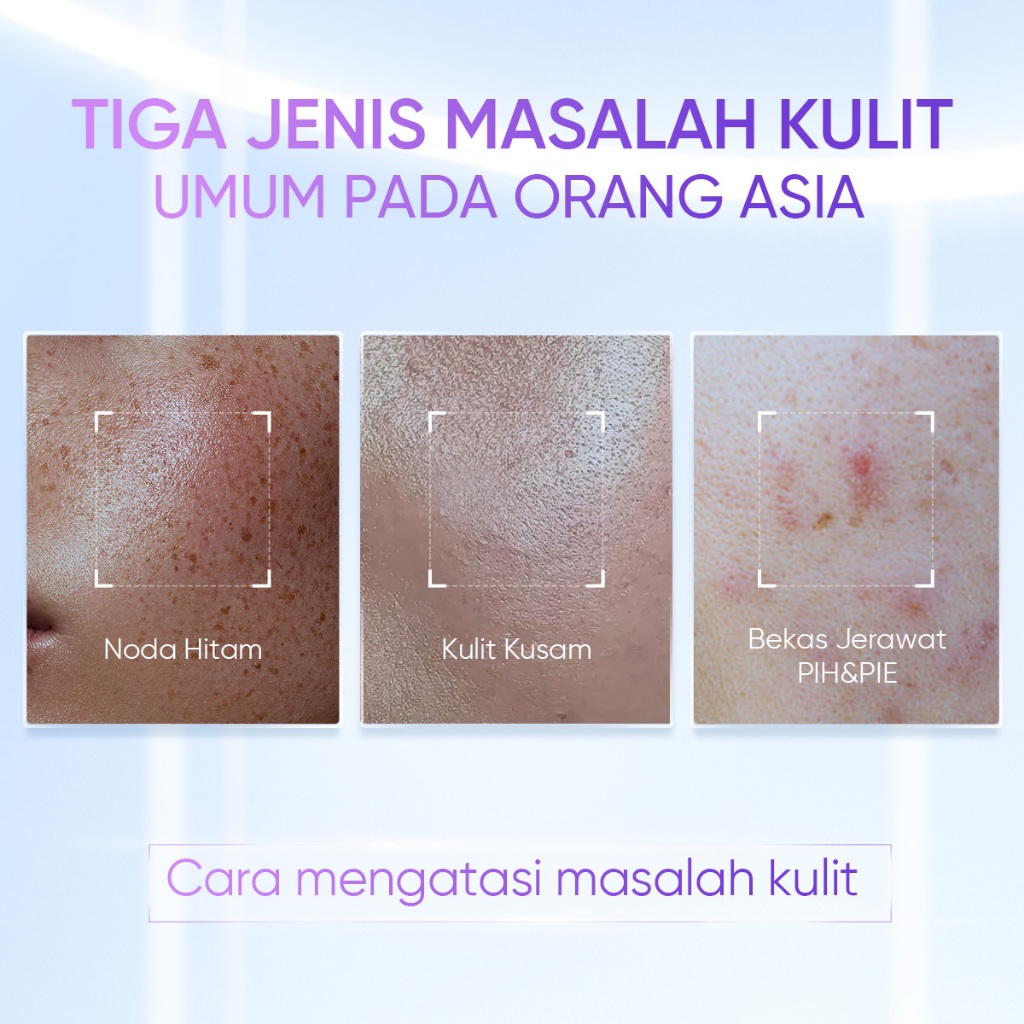SKINTIFIC - 2PCS 377 Dark Spot Set / Moisturizer 30g + Serum 20ml - 14 Hari Flek Hitam Samar Menyamarkan Noda Hitam Warna Kulit Tidak Merata Kulit Kusam Bekas Jerawat PIH&PIE mencerahkan kulit Glass Skin Brightening Glowing Moist Whitening Moisture Ge - Gambar 2