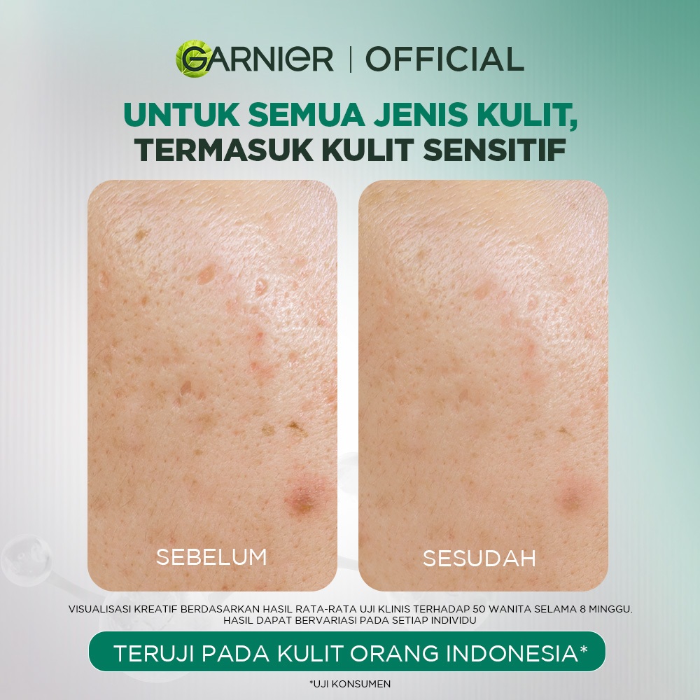 GARNIER Tri Acid Renew Peeling Serum Exfoliasi Wajah - Glass Skin AHA BHA PHA 10% Niacinamide 5% Skincare Exfoliating Renewal Concentrate kulit ideal daily safe for sensitive skin exfoliant serum mencerahkan wajah - Gambar 4