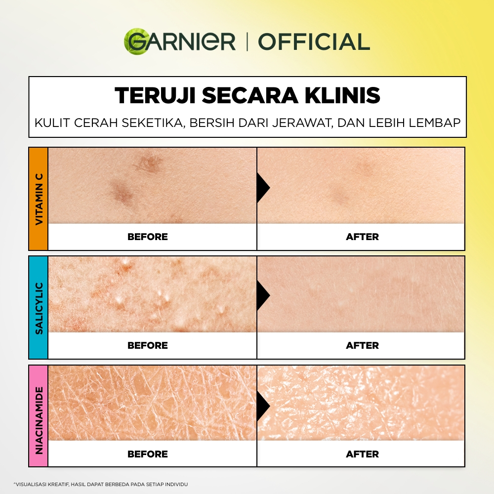 [BARU] Garnier Low pH Facial Wash Gentle Skin Cleanser 100ml 1pc/2pcs/3pcs/5pcs- Pembersih Wajah Low pH Lembut Face Wash Anti Jerawat Skincare Pembersih Wajah sabun cuci muka sabun muka glowing - Gambar 4