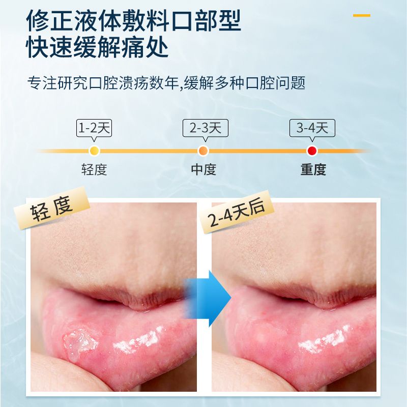 Correct oral Ulcers Fire Foaming Spray Antibacterial Bad Mouth Tongue