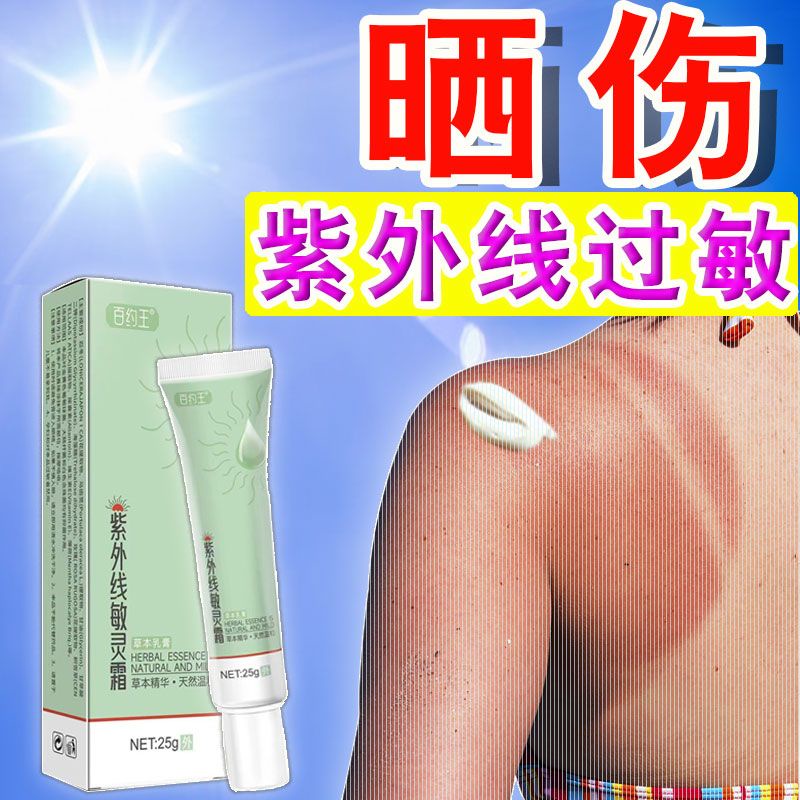Red Skin Peeling Sunburn Skin Allergy Sunlight Dermatitis Arm Face Aft 