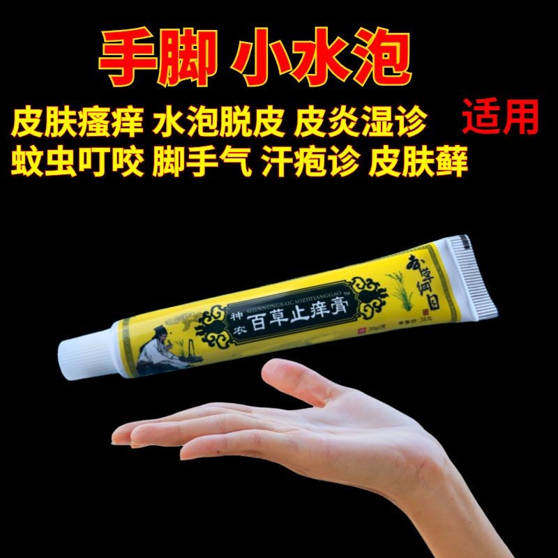 Luck itching cream itchy skin hand long moss sweat hand Antiitch cream