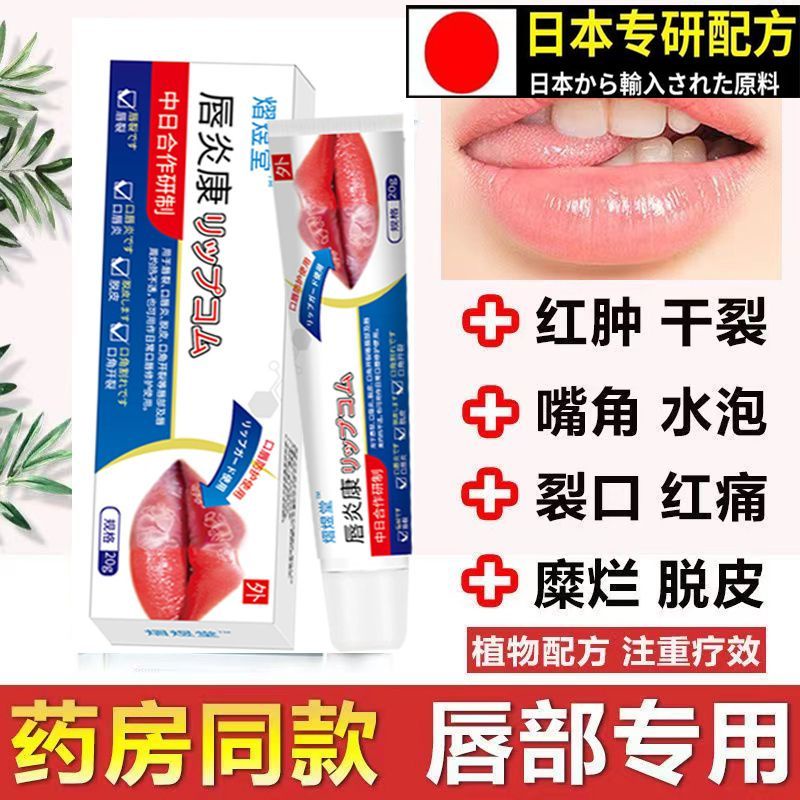 Allergic pericheilitis, angular stomatitis, dry, peeling, cr Allergic