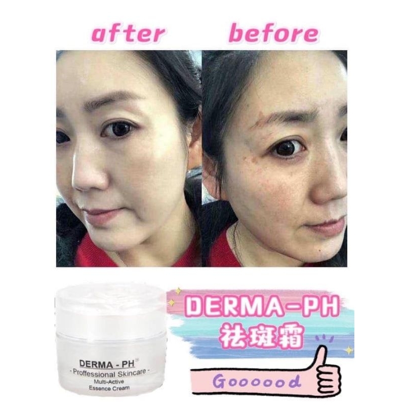 DERMA -PH ESSENCE CREAM ( FREE FACE MASK) | Shopee Singapore