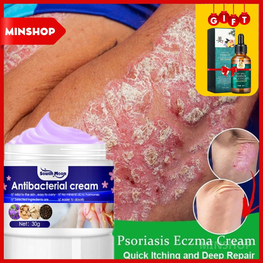 Antibacterial Cream Dermatitis Eczematoid Ointment Effective Anti-Itch ...