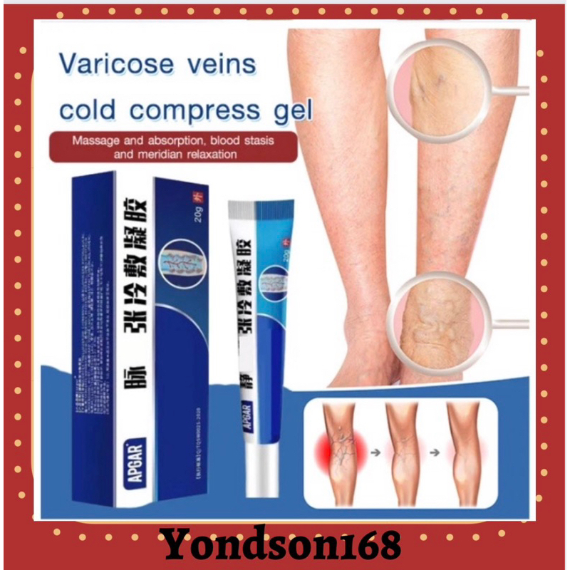 Varicose vein cold compress gel Swollen Worm Leg Care Body Balm vein