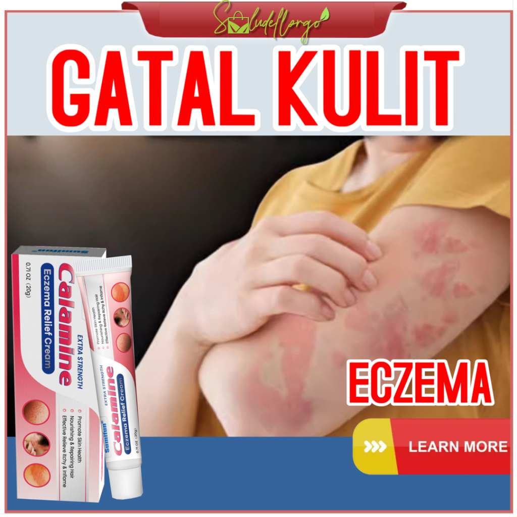 Itching Of Watery Skin Eczema Calamine Dermatitis Dry Snooping Skin ...