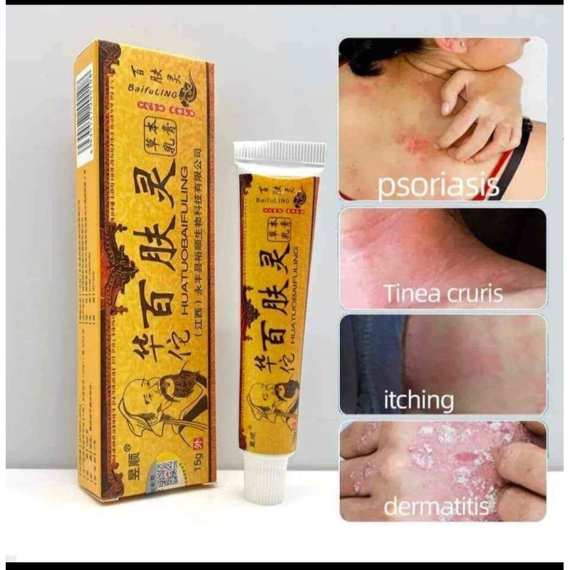 Psoriasis ringworm Eczema Scabies Itchy Ringworm Red Rashes gatal kudis ...