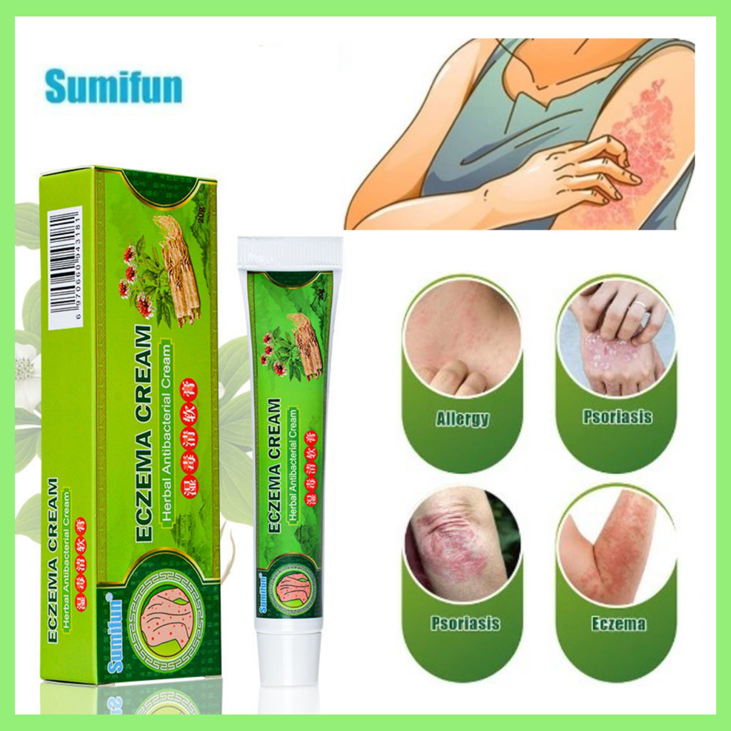 Eczema cream itchy skin medicine ringworm medicine psoriasis cream ...