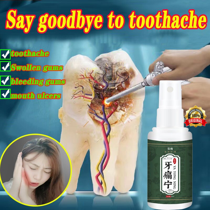 Toothache Treatment Spray Relieves Periodontitis Tooth Decay Pains ...