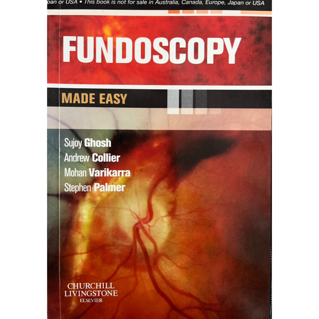 FUNDOSCOPY Made Easy | Shopee Singapore