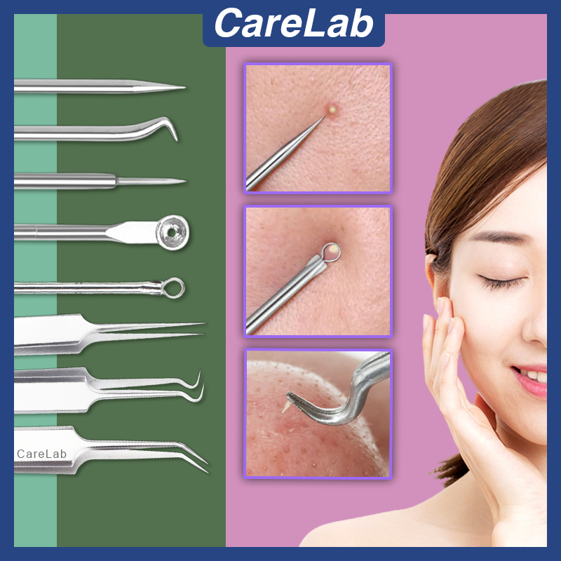 Pimple Acne Removal Blackhead Needle Tweezers Jerawat Whitehead Remove ...