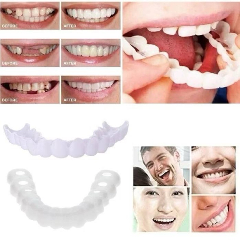 Fake teeth gigi palsu crown teeth tapak gigi penutup semua masalah gigi ...