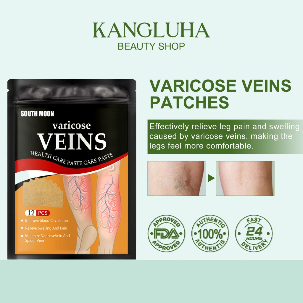 South Moon Varicose Veins Patches Legs Natural Varicose Veins Treatment ...