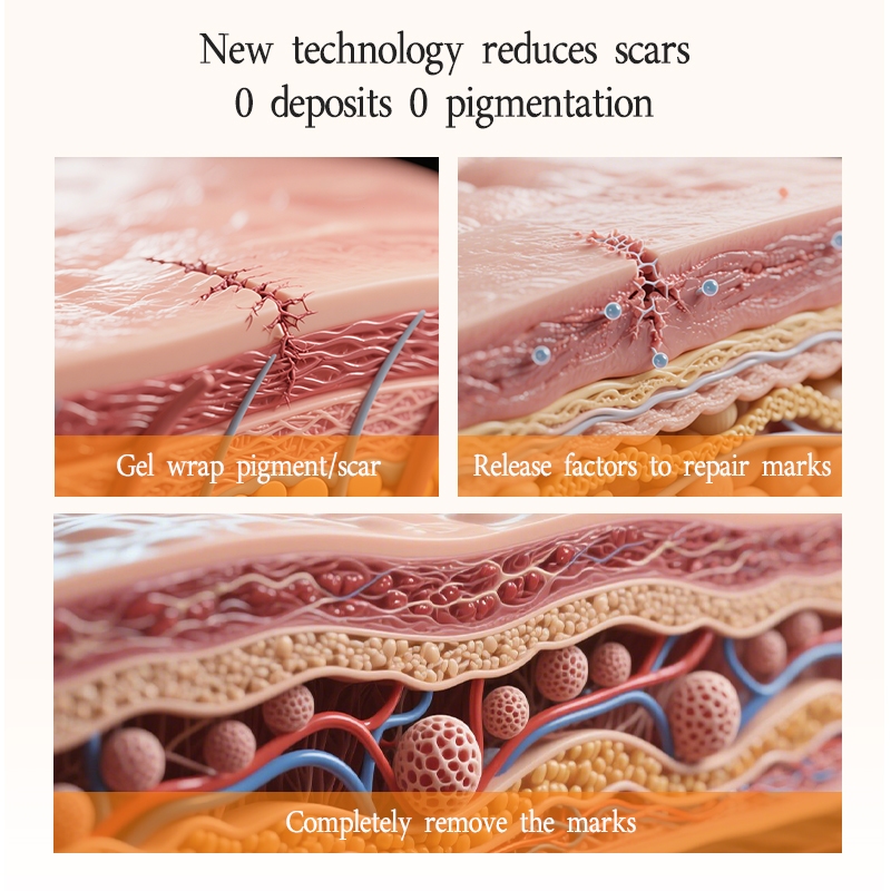 Product image Scar Removal Cream Treatment Remove Stretch Marks Acne Scar Repair Cream Burns Scald Repair祛疤膏 5