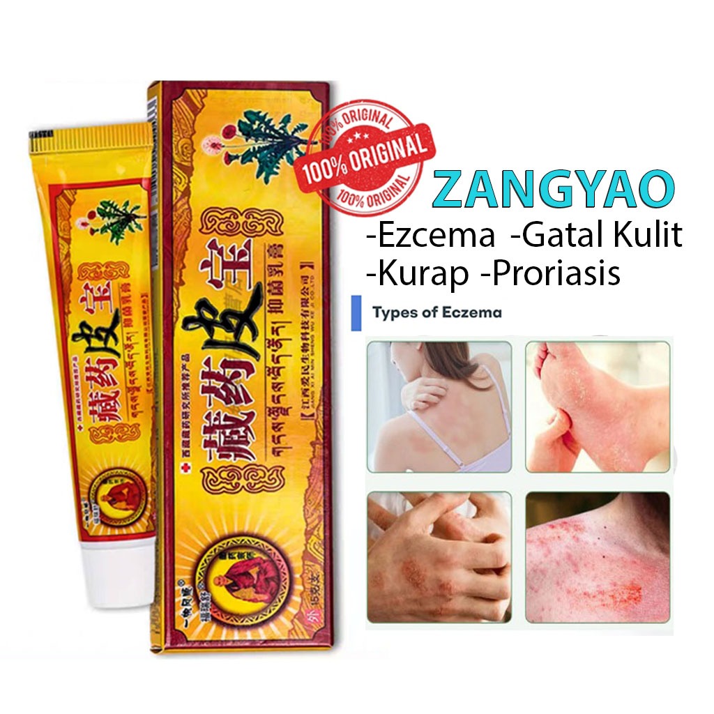 Ekzema Psoriasis Ringworm Itchy Skin Medicine Chinese Herbal Cream 15g ...