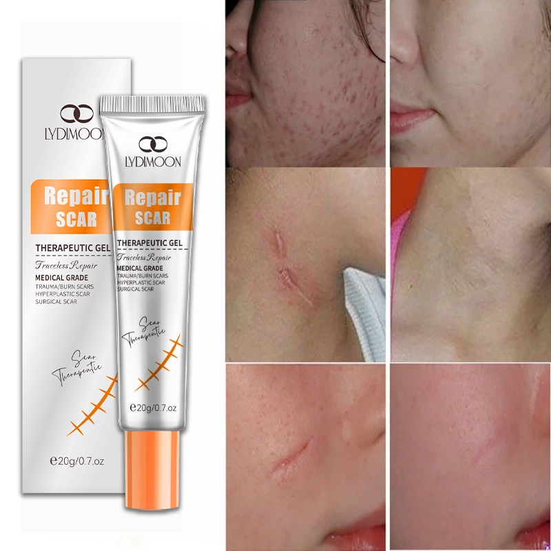 Product image Scar Removal Cream Treatment Remove Stretch Marks Acne Scar Repair Cream Burns Scald Repair祛疤膏 2