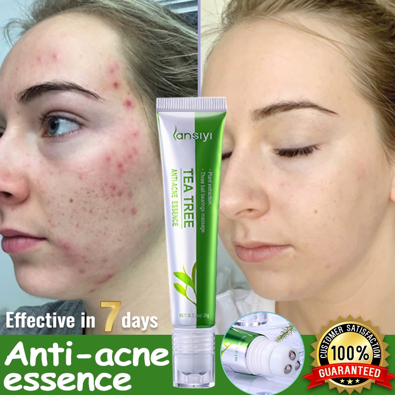Tea Tree Acne Scar Gel Remover Pimple Prick Scar Gel Remover Cream For