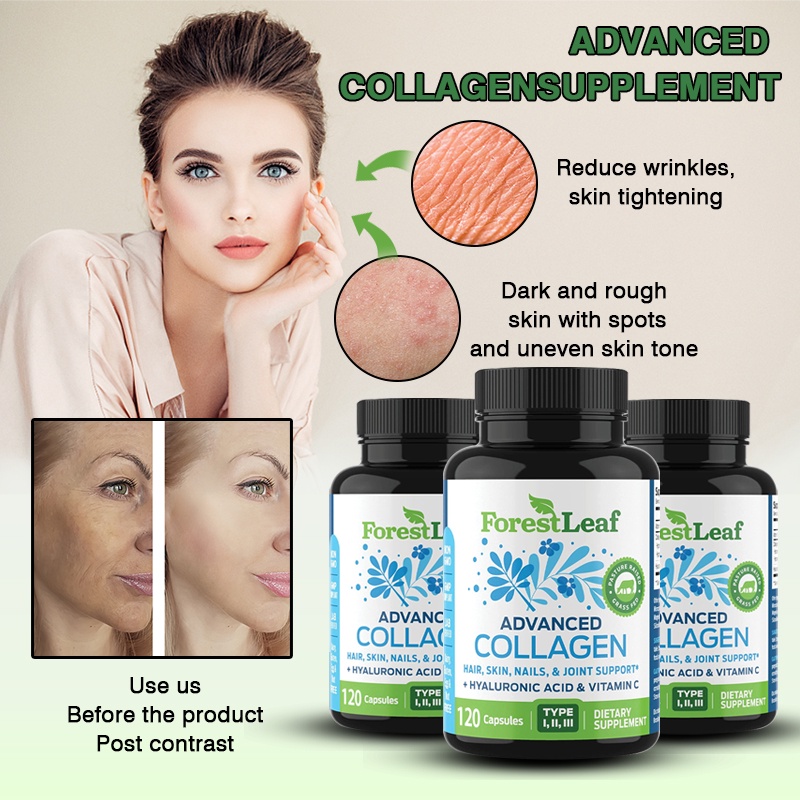 Collagen Pills with Hyaluronic Acid and Vitamin C - Reduces Wrinkles, Firms Skin, Promotes Healthy Hair, Skin, Nails and Joints - Hydrolyzed Collagen Peptides Supplement