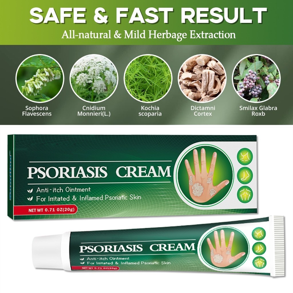 Eczema Treatment Antibacterial Cream Anti Fungal Anti Itch Sweat Herpes