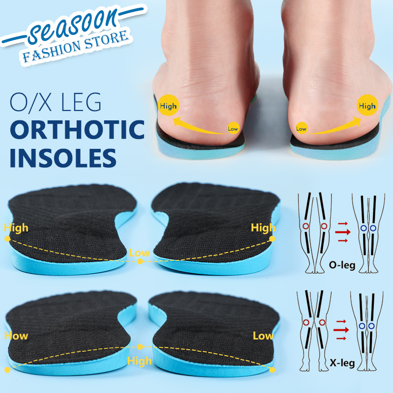 O/X Leg Flat Foot Orthopedic Insoles Arch Support Shoes Pad for Adult ...