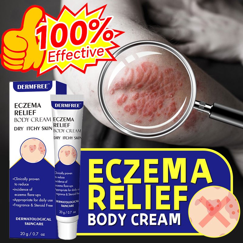 Psoriasis Cream Dermatitis Eczematoid Eczema Pruritus Ointment ...