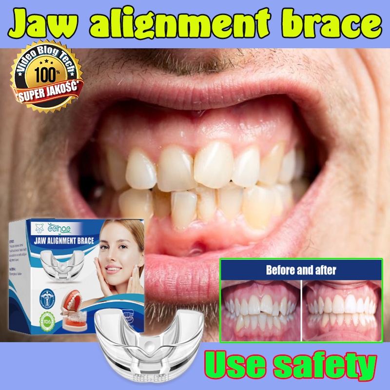 Dental Orthodontic Appliance Teeth Alignment Teeth Aligner Trainer ...