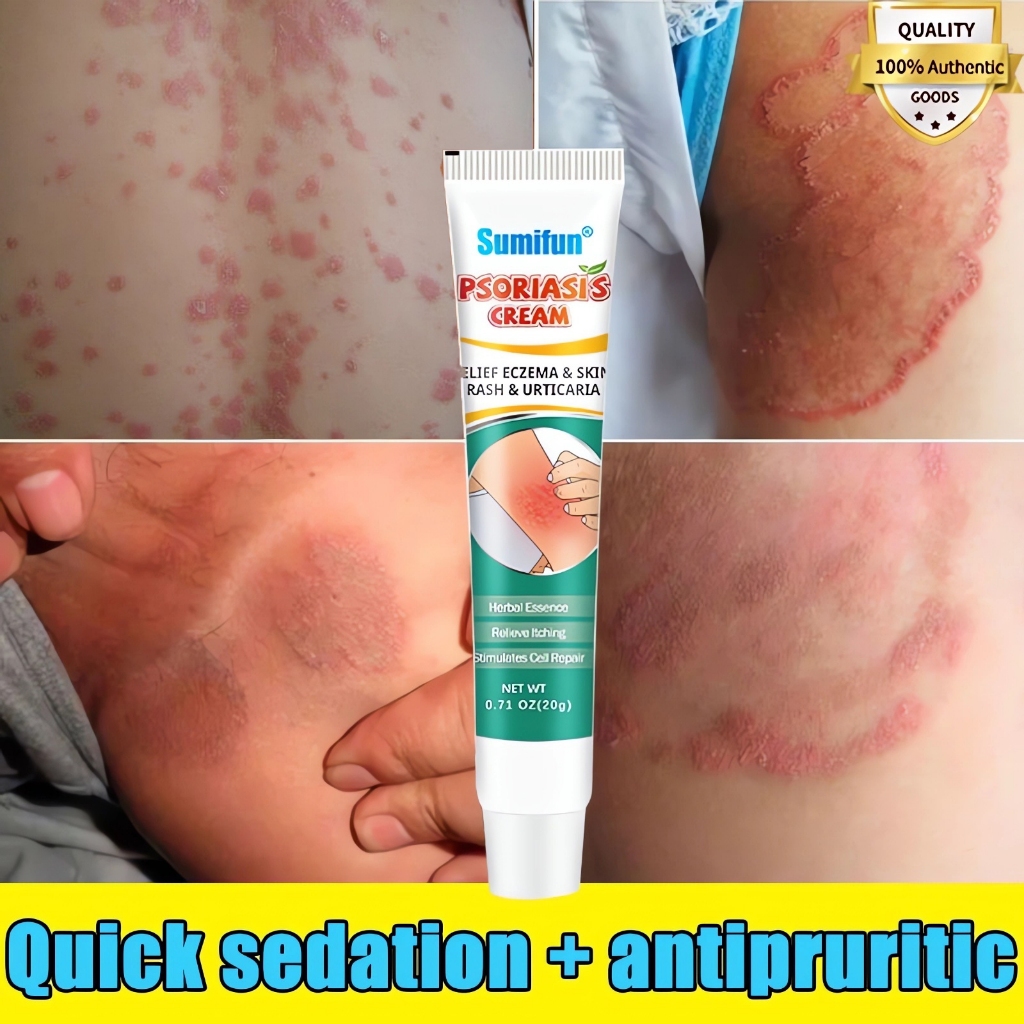 Antibacterial Cream 20ml used to relieve dermatitis and rashes(Eczema