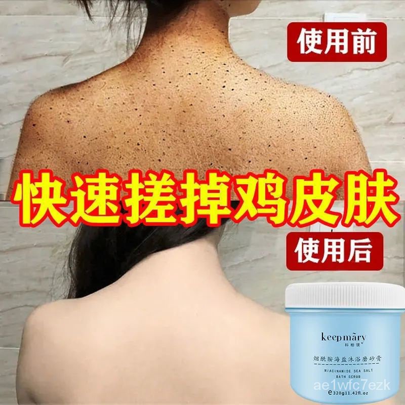 Chicken skin savior body scrub to remove chicken skin, exfoliate, whiten and remove skin pimples