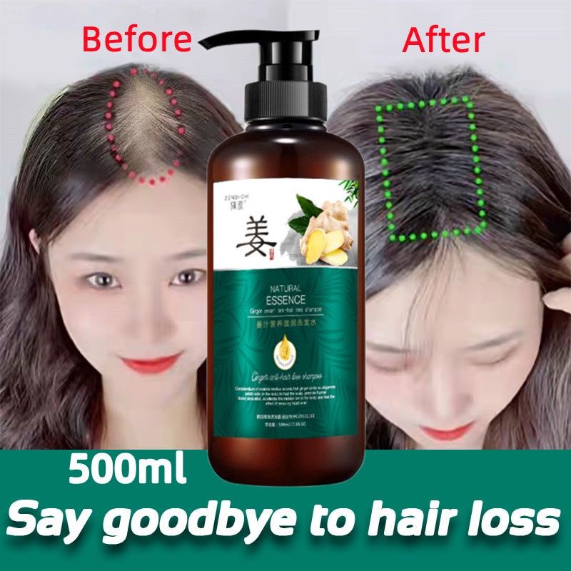 SAMPO Zhenxiu Ginger Hair Growth Shampoo/Anti-Fall Ginger Shampoo Anti ...
