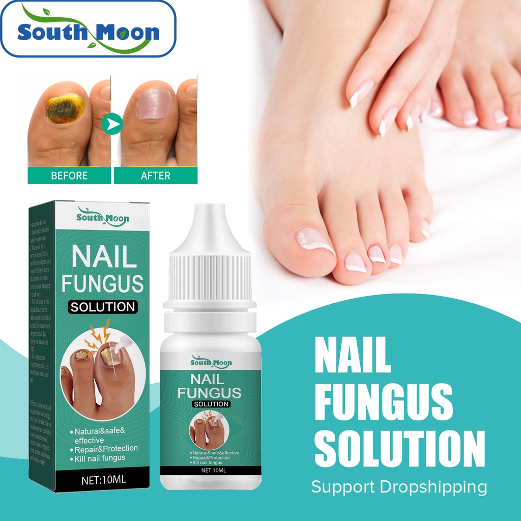 South Moon 10ml Nail Fungus Solution Serum Ingrown Toenail Fungal ...