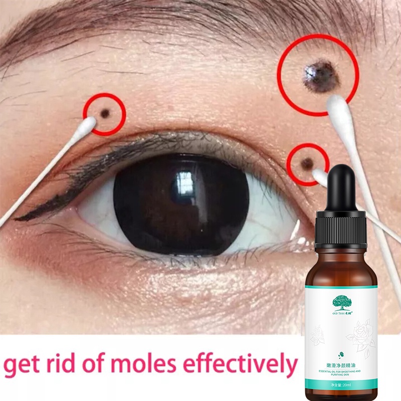 Mole Remover Essence 20ml Lighten Melanin Remove Moles Skin Care Light