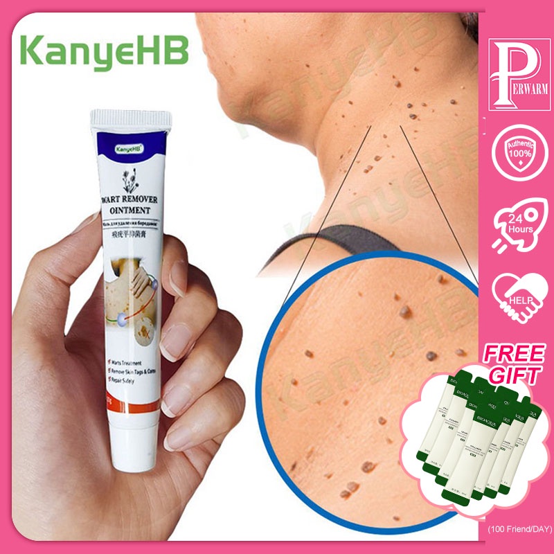 Ready StockWart Removal Ointment Wart Treatment Cream Neck Skin Tag