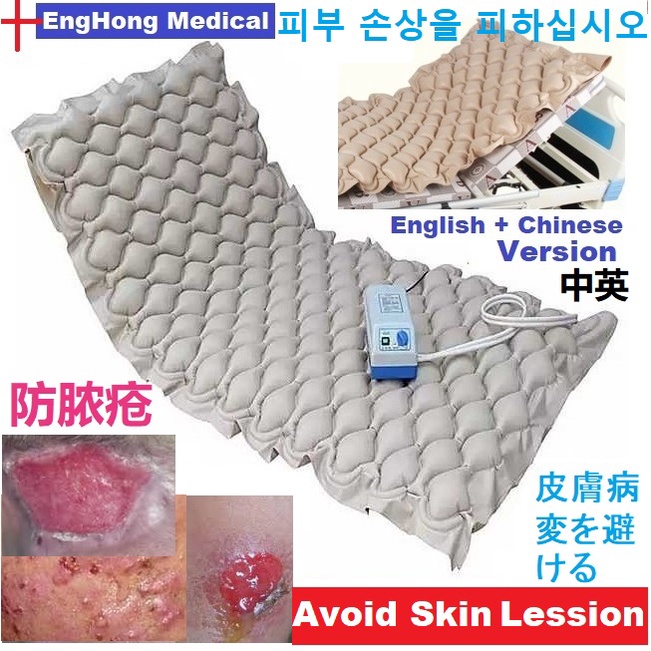 EngHong Ripple Mattress Air Mattress Hospital bed Medical Bed, Avoid