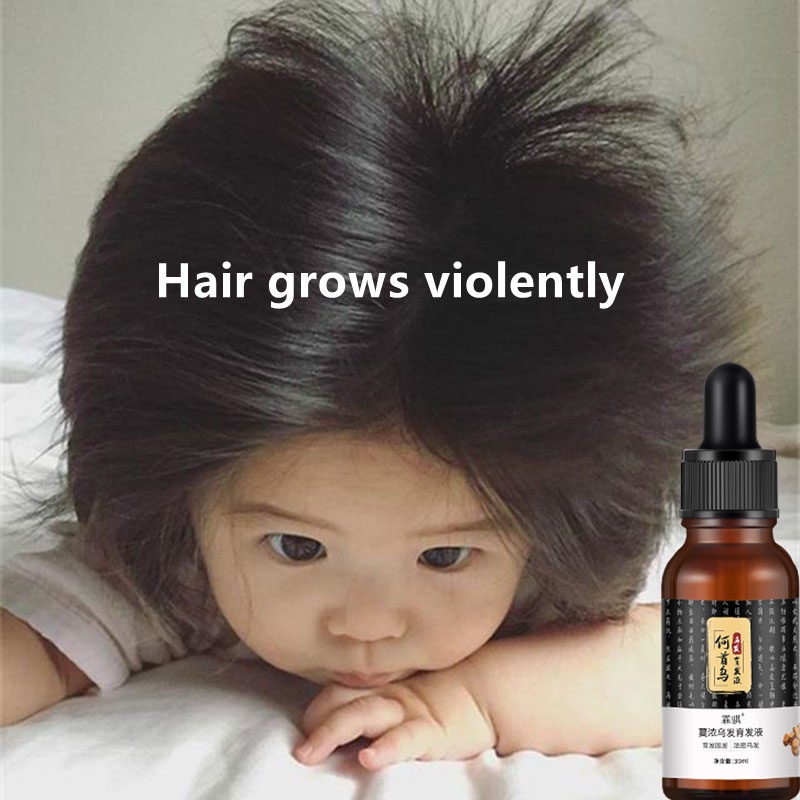 【shipped in Singapore】 Ginger Tonic hair serum 30Ml Hair Treat Hair