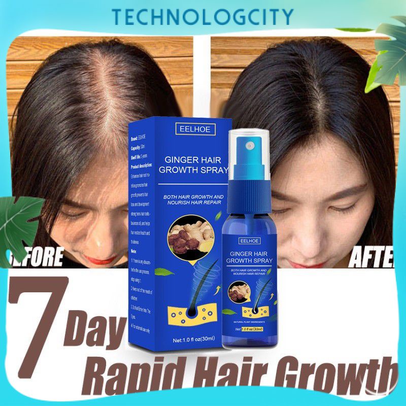 Ginger Hair Growth Spray Anti Hair Loss Fast Grow Hair Hair Protection ...